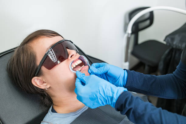 Best Emergency Wisdom Tooth Extraction in Skidaway Island, GA