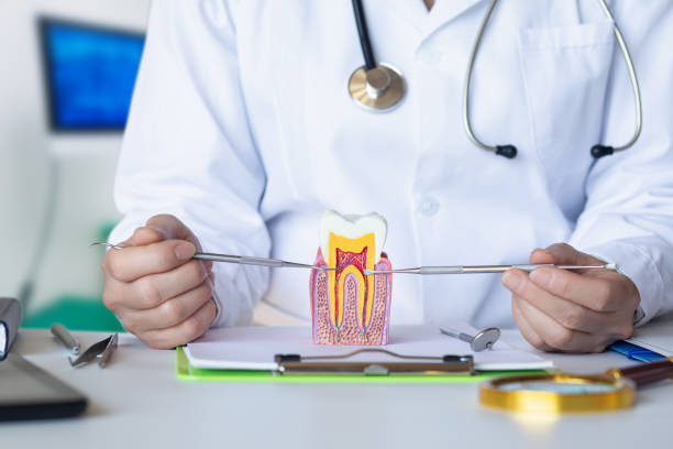 Best Knocked-Out Tooth (Avulsed Tooth) Treatment in Skidaway Island, GA